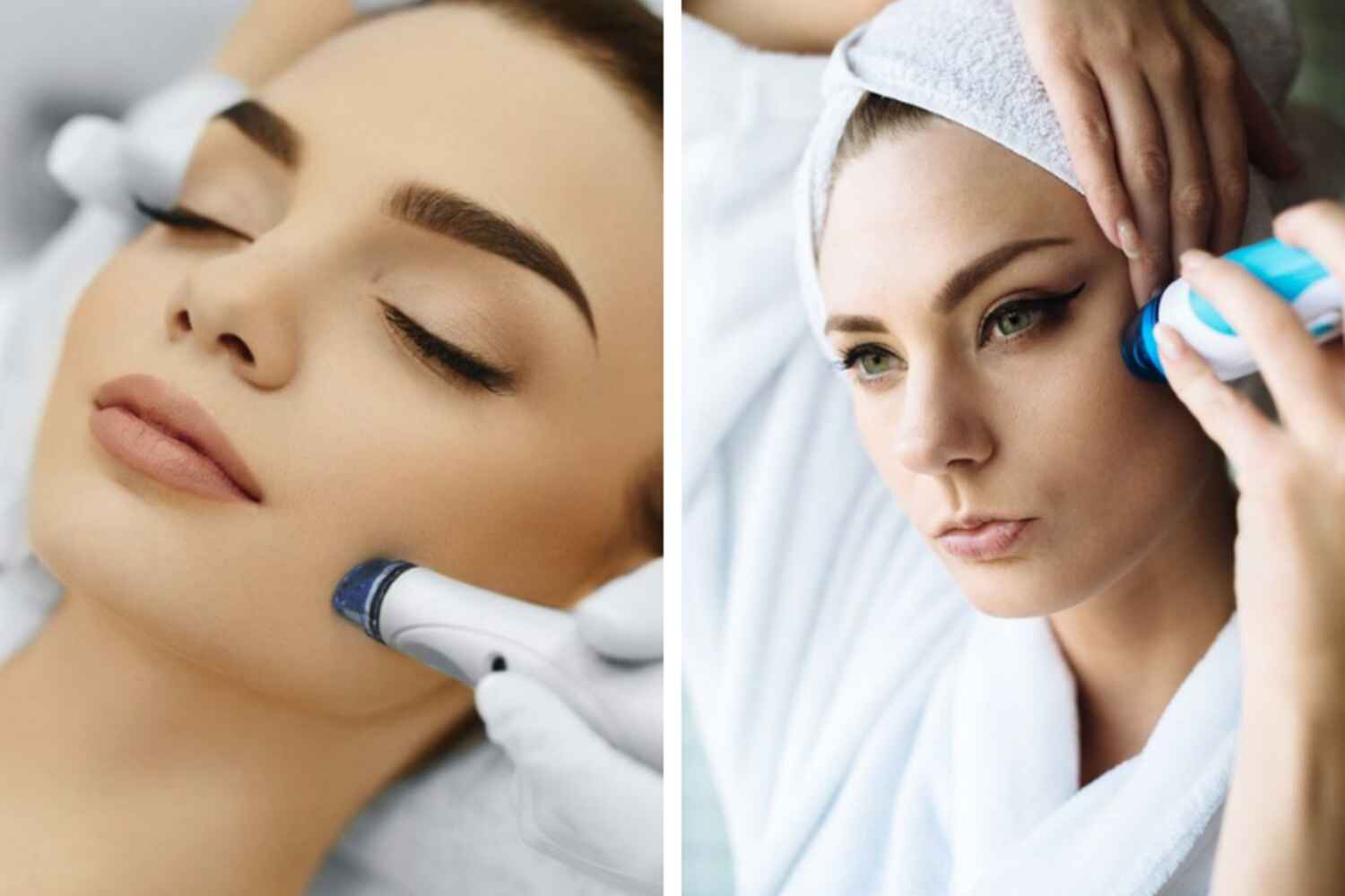 Le peeling dermatologique objectif peau nette