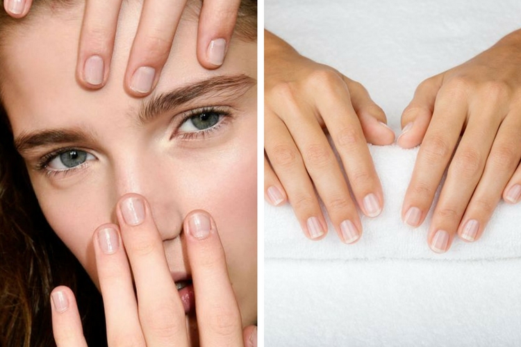 Ongles striés : que faire ?