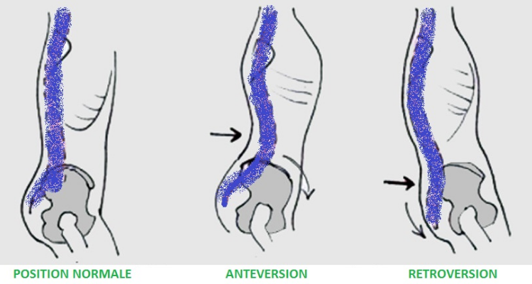 position du bassin en retroversion posture pilates stomach vacuum